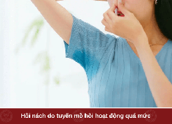 Bật mí cách trị hôi nách hiệu quả bằng phương pháp Đông Y